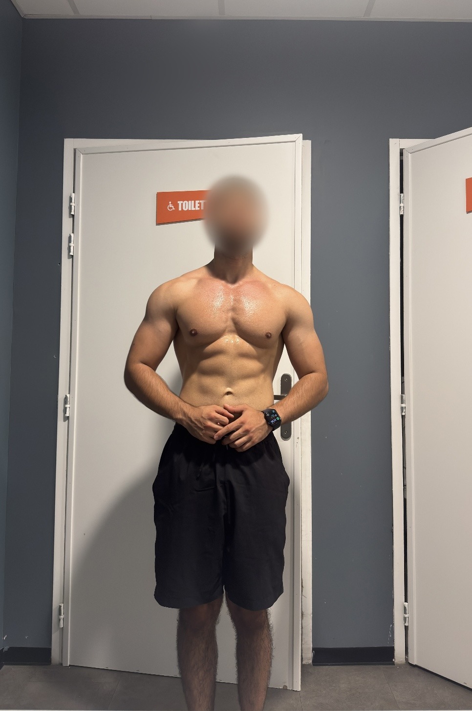 Profilo di Blanchard